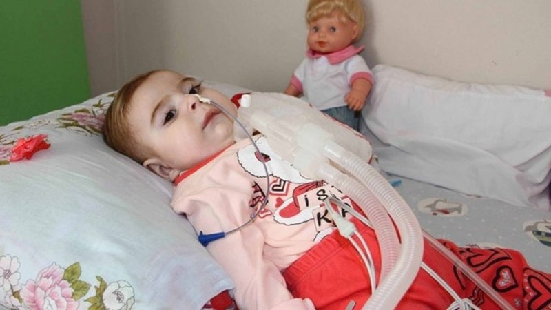 SMA hastalığı ile ilgili merak edilenler