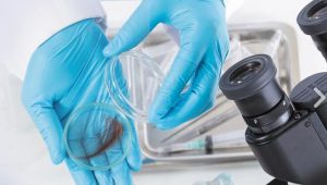 Bir Tutam Saçtan Hastalığınızı Öğrenin