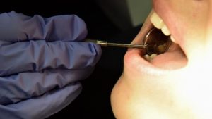 2020’de 100 bin hasta diş tedavisi için Türkiye’ye geldi