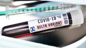 Bilim Kurulu Üyesi Kayıpmaz: Delta Plus’tan korunmanın yolu aşı