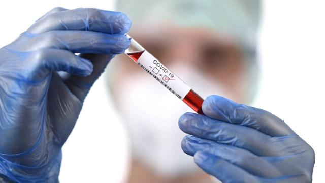 Sahte aşı kartı ve negatif PCR testinin cezası nedir?