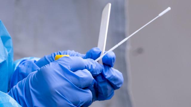 PCR zorunluluğu vakaların tespitini sağladı