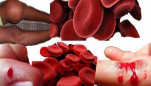 Hemofiliyle mücadelede toplumsal farkındalığın önemi kritik