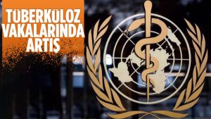 Tüberküloz vakaları 20 yıl sonra yeniden artışa geçti