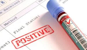 Türkiye, Avrupa Birliği ülkeleri içinde HIV hastalarının en hızlı arttığı ülkeler arasında yer alıyor.