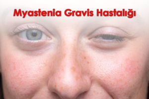 Göz kapaklarında düşüklük ve çift görme, konuşma, yutma güçlüğü, kollar ve bacaklarda oluşan kas güçsüzlüğü