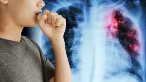 Diyabetli bireyler zatürre açısından risk altında