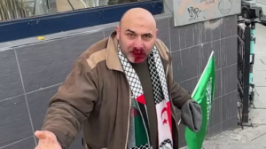 Maçla başladı, yumrukla devam ediyor