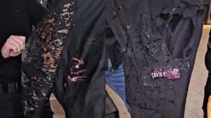 Saraçhane’deki gösterilerde bir polis memuruna, terörist mandallalar tarafından asit atıldı