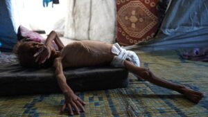 İsrail’in abluka ve saldırısı altındaki Gazze Şeridi’nde gönüllü görev yapan Filistin asıllı Amerikalı hemşire Amanda Nasır, İsrail soykırımı Gazze’yi yok etti