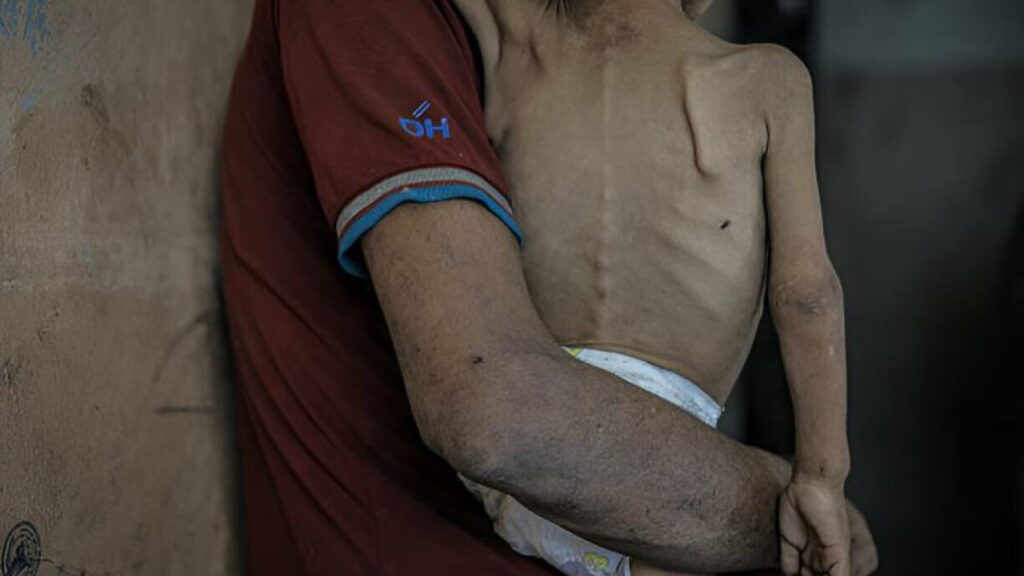 Gazze “açlıktan” ölüyor!