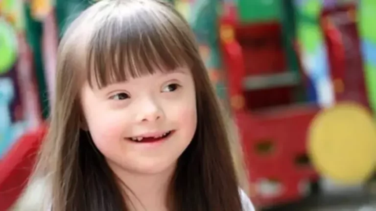 Türkiye’de her yıl yaklaşık bin 500 bebek Down sendromu ile doğuyor